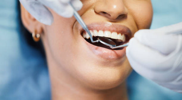 Best After-Hours Emergency Dentist in Maysville, MO