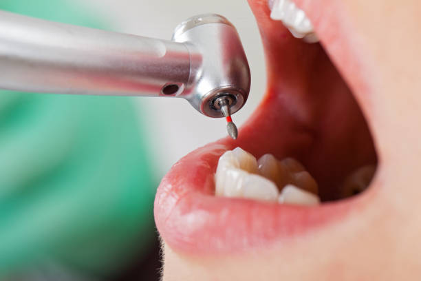 Best Walk-In Emergency Dentist in Maysville, MO